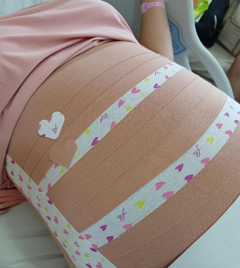 Bandagem elástica cobrindo o abdômen de uma gestante, finalizada com uma faixa estampada
